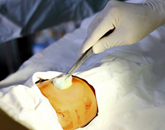 Das Schwerbrandverletztenzentrum im Zentrum für Plastische und Handchirurgie im Klinikum St. Georg in Leipzig